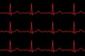 Ekg lines. Heartbeat. Seamless pattern Royalty Free Stock Photo