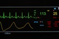 EKG monitor in ICU unit