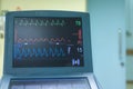 EKG monitor in intra aortic balloon pump machine.