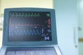 EKG monitor in intra aortic balloon pump machine.