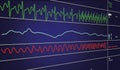 EKG monitor in intra aortic balloon pump machine in icu on blur background, Brain waves in electroencephalogram, heart rate wave