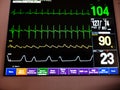 EKG, Pulse, BP and Respiration ICU Monitor Screen