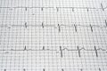 EKG Readout Royalty Free Stock Photo