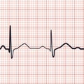 EKG seamless vector pattern Royalty Free Stock Photo