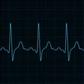 EKG seamless vector pattern Royalty Free Stock Photo