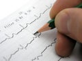 EKG test results Royalty Free Stock Photo