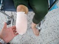 Elastic bandaging in diabetes mellitus Royalty Free Stock Photo