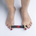 Elastic toe separator to correct hallux valgus or bunion Royalty Free Stock Photo