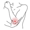 Elbow pain location. Bursitis of arm joint dislocated sprain arthritis arthrosis epicondylitis