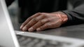 Man typing on computer keyboard in office or at home. Close-up of wrist pain, highlighting discomfort and inflammation, concept of Royalty Free Stock Photo