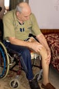 Elderly amputee with a prosthetic leg