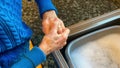 Elderly female applying hand cream to old wrinkled cracked dry hands to moisturise for skin care