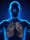 Elderly Male with Lung Cancer Illustration Royalty Free Stock Photo