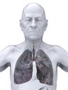 Elderly Male with Lung Cancer Illustration Royalty Free Stock Photo