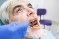 Elderly man with bad teeth. Royalty Free Stock Photo