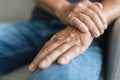 Elderly man suffering from psoriasis on hands Royalty Free Stock Photo