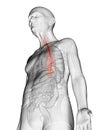 An elderly mans esophagus