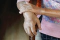 Elderly swollen hand or edema hand Royalty Free Stock Photo