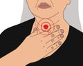 Elderly woman difficulty swallowing, dysphagia, unhealth, illustration on white background Royalty Free Stock Photo