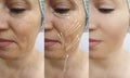 Elderly woman face sagging aging contrast collagen arrow plastic mature effect tightening before after treatment Royalty Free Stock Photo