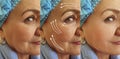 Elderly woman face wrinkles before  after treatment Royalty Free Stock Photo