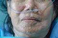 Elderly woman with nasal breathing tube