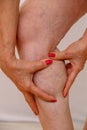 Elderly woman in underwear shows closeup on varicose veins on her legs. Photo on a light isolated background. Royalty Free Stock Photo