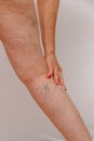 An elderly woman in white panties is touching her legs with cellulite and varicose veins on a light isolated background. Royalty Free Stock Photo