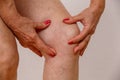 An elderly woman in white panties is touching her legs with cellulite and varicose veins on a light isolated background. Royalty Free Stock Photo