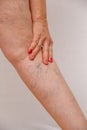 An elderly woman in white panties is touching her legs with cellulite and varicose veins on a light isolated background. Royalty Free Stock Photo