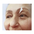 Elderly woman wrinkles face before and after concept procedures Royalty Free Stock Photo