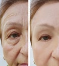 Elderly woman wrinkles face before and after aging procedures Royalty Free Stock Photo