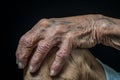 an elderly womans hands on her knee