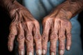 an elderly womans hands with wrinkles