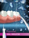 Electric Oral Irrigator ads. Vector 3d Illustration with Portable Water Pick Flosser.