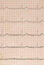 Electro-encephalogramme Royalty Free Stock Photo