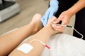 Electroacupuncture dry with needle on female ankle. Royalty Free Stock Photo