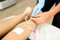 Electroacupuncture dry with needle on female ankle. Royalty Free Stock Photo