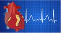 Electrocardiogram Royalty Free Stock Photo