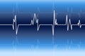 Electrocardiogram Royalty Free Stock Photo