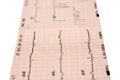 Electrocardiogram Royalty Free Stock Photo