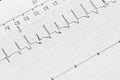 Electrocardiogram, Cardiac Arrhythmia