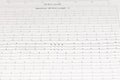 EKG chart Cardiac Arrhythmia on paper