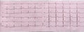 Electrocardiogram close-up on paper, cardiology and health care