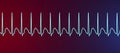 Electrocardiogram displaying supraventricular tachycardia, 3D illustration