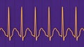 Electrocardiogram displaying supraventricular tachycardia, 3D illustration