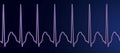 Electrocardiogram displaying supraventricular tachycardia, 3D illustration