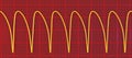 Electrocardiogram displaying ventricular tachycardia, 3D illustration