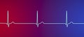 Electrocardiogram ECG displaying a junctional rhythm, 3D illustration