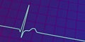 Electrocardiogram ECG displaying a junctional rhythm, 3D illustration